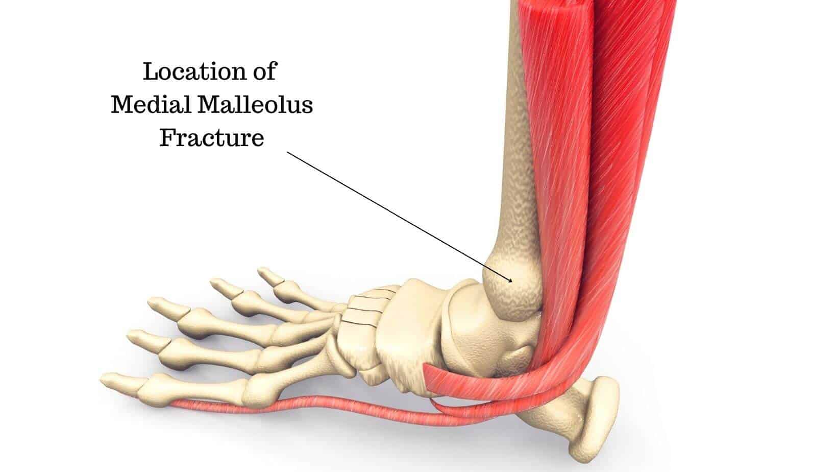 Causes of Inner Ankle Pain Explained by a Foot Specialist