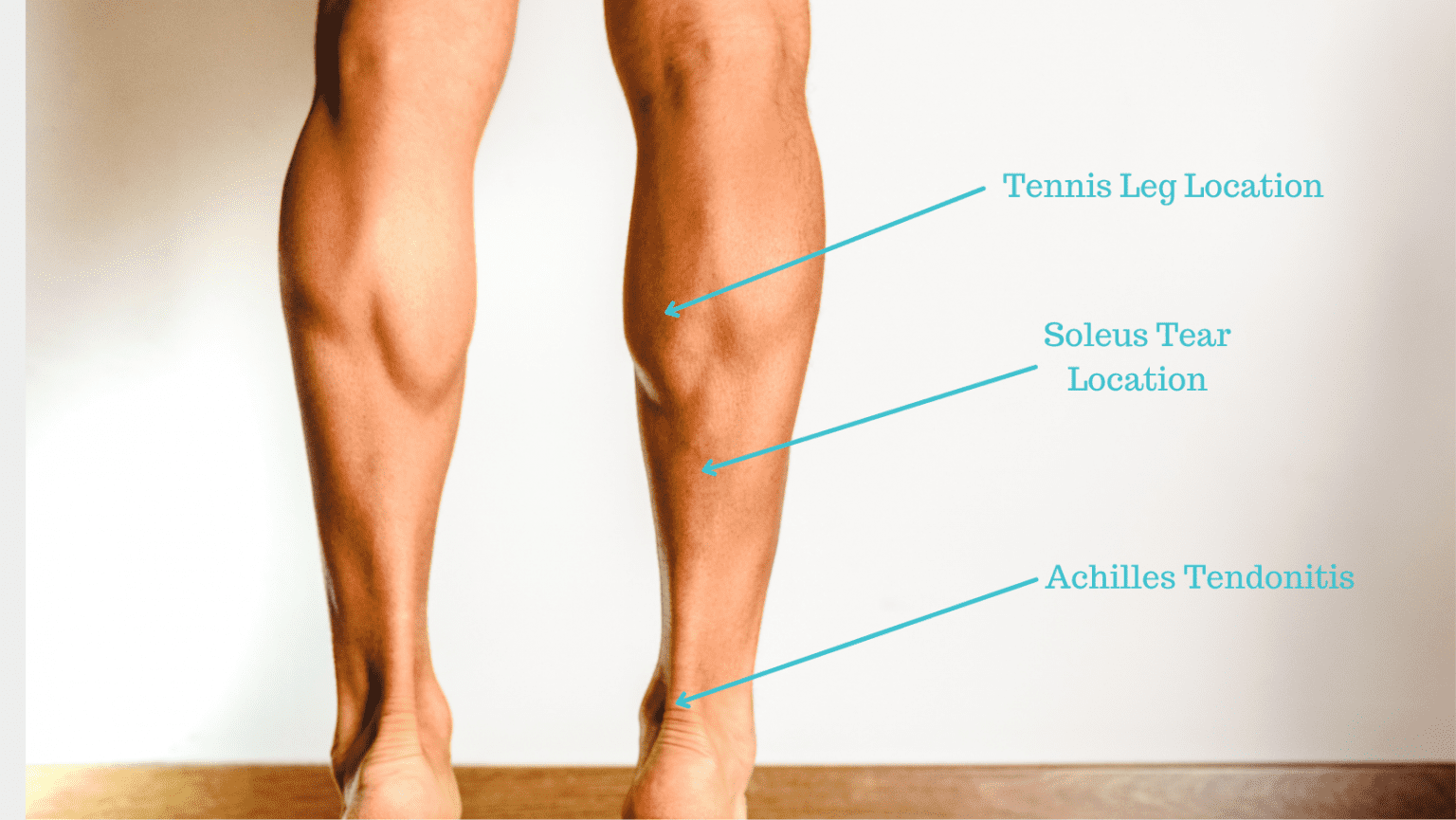 Sudden Muscle Pull In Calf