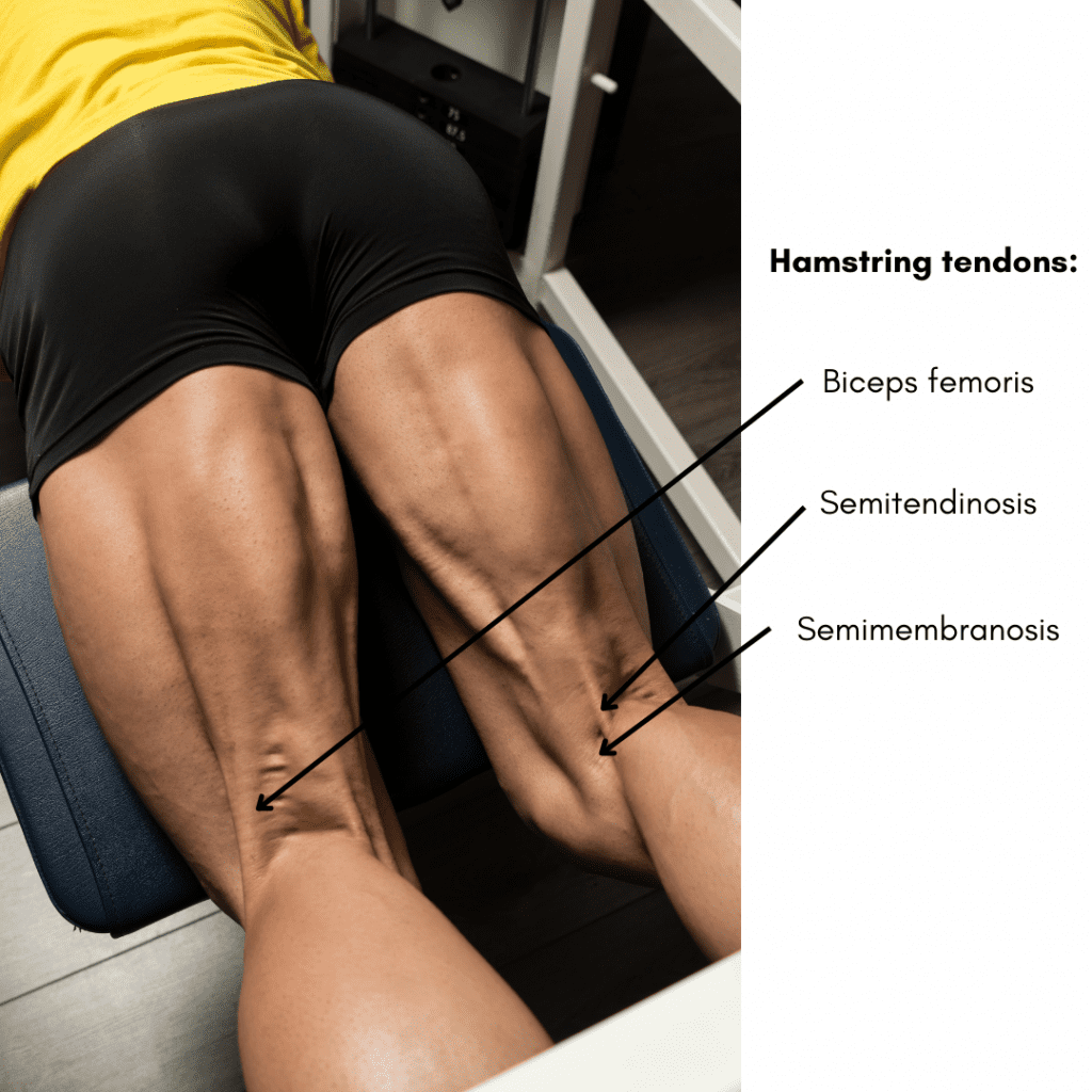 Photo of hamstring tendons