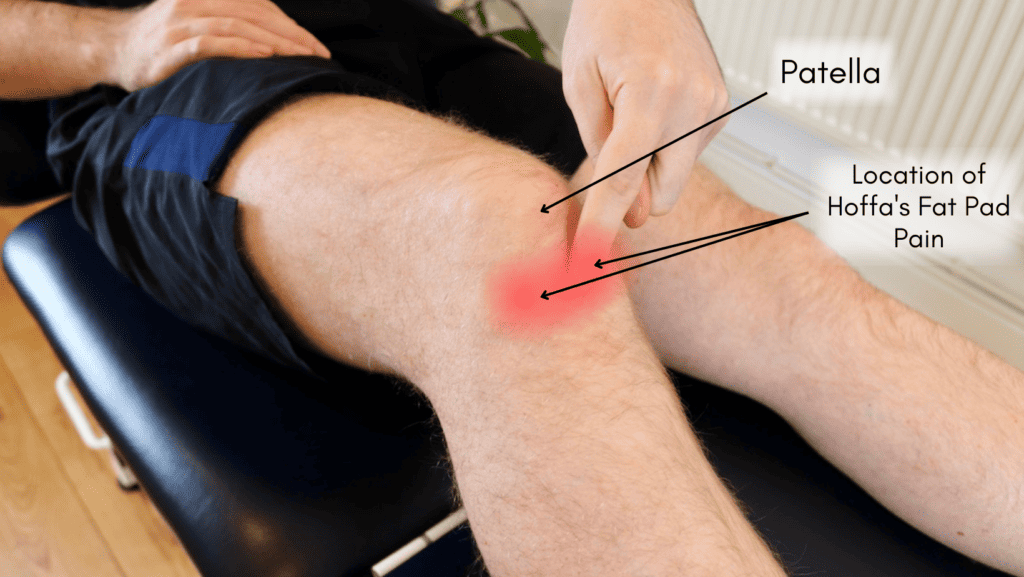 Heel Pain: Causes, Diagnosis & Physiotherapy Treatment