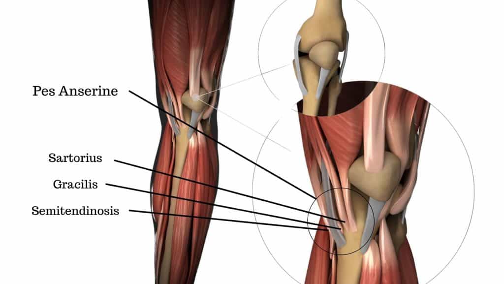 Diagram of pes anserine bursitis