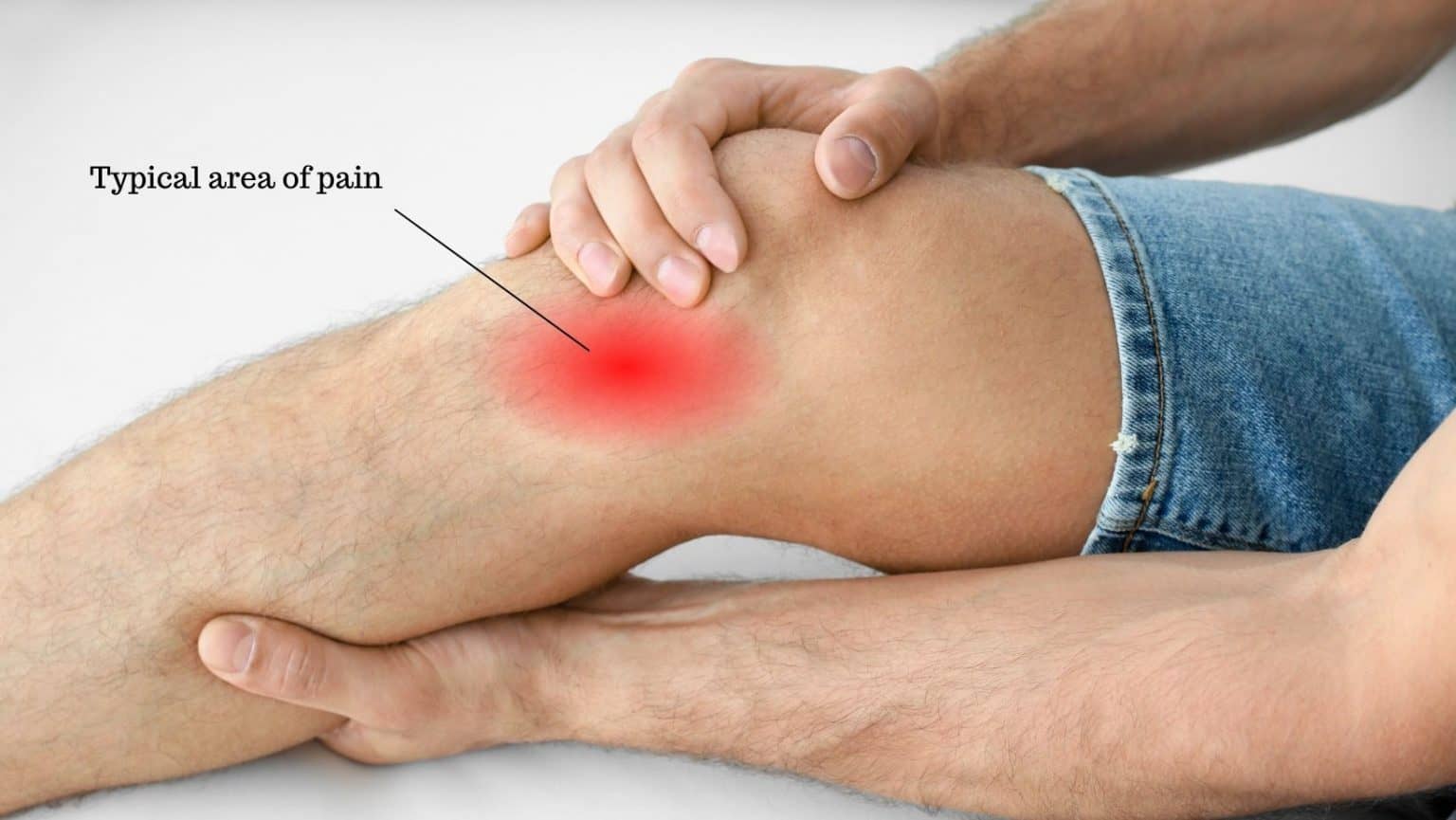 Pes Anserine Bursitis: Treatment