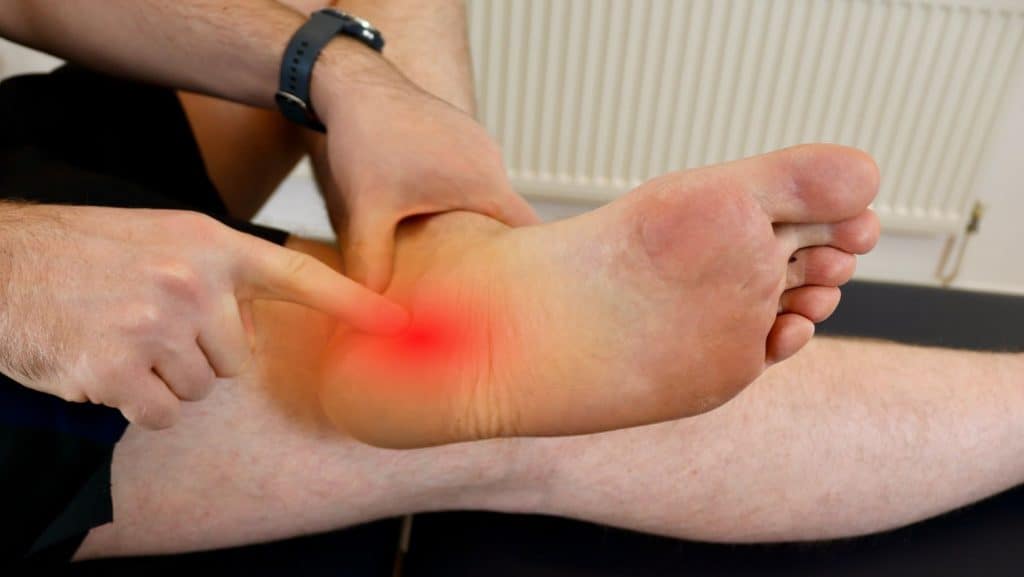 Picture of a person pointing to plantar fasciitis