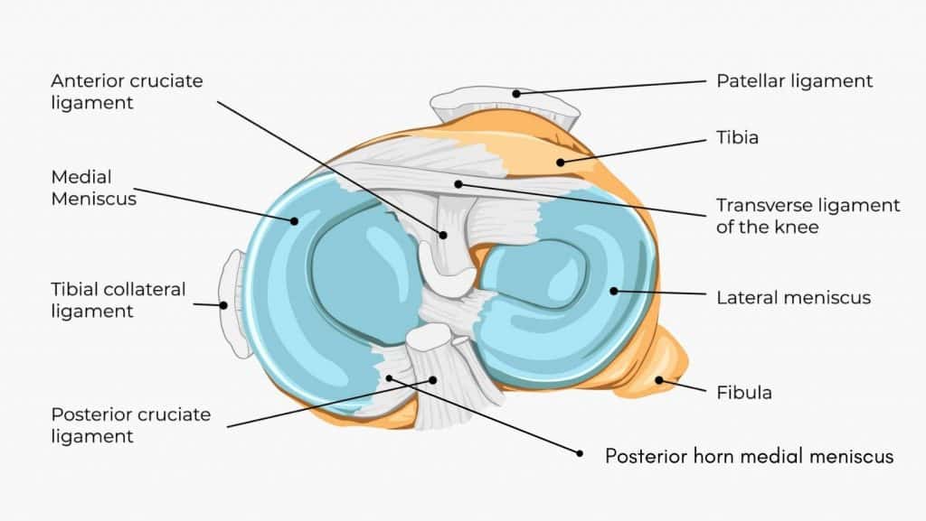 Diagram of meniscus with posterior horn marked