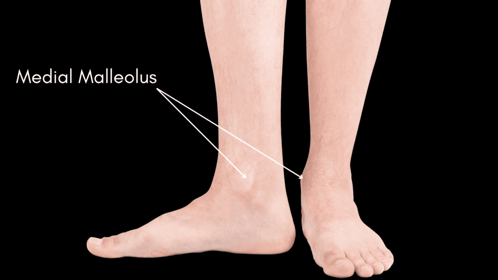 Picture of Medial Malleolus | Medial Malleolus Pain