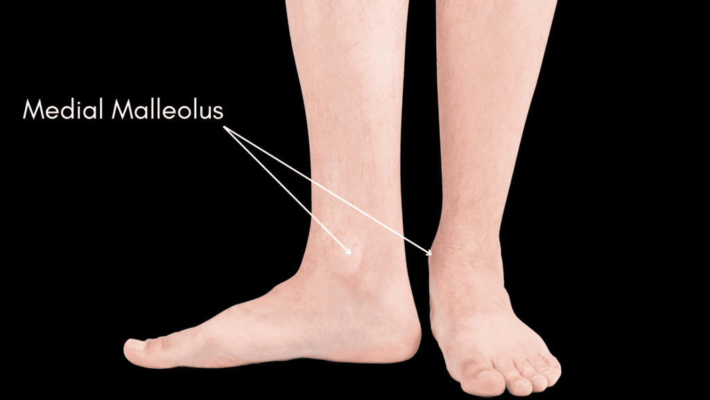 Medial Malleolus