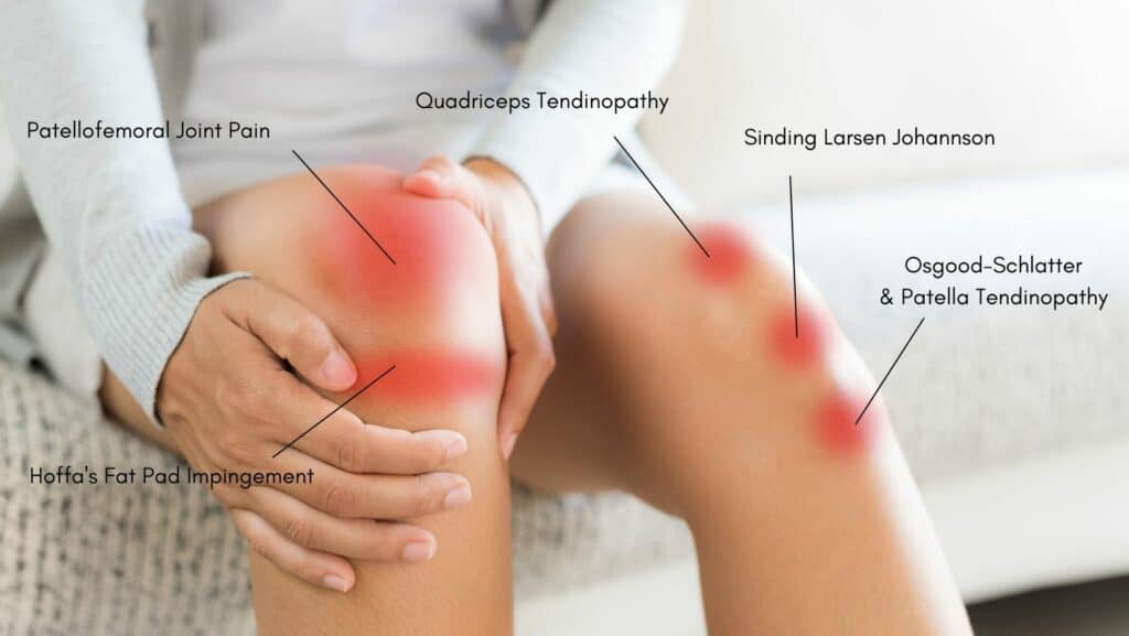 self-diagnosing-knee-pain-vancouver-chiropractic-care