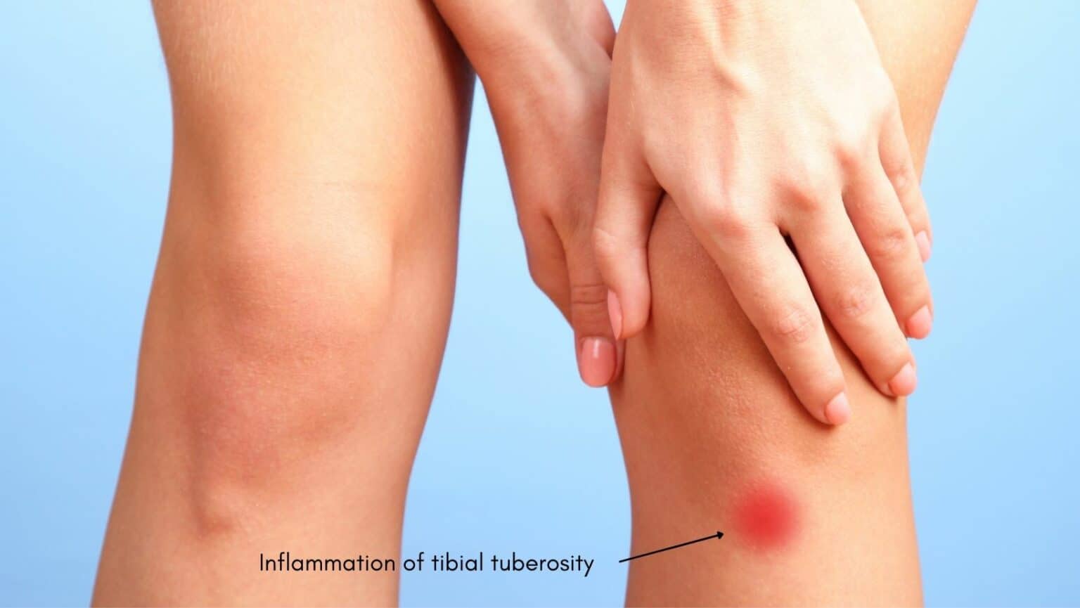 OsgoodSchlatter Disease Physical Therapy and Exercises