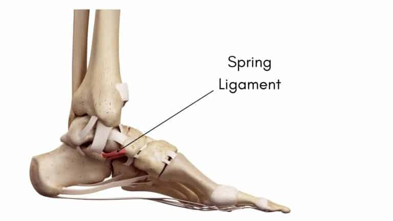 Spring Ligament: Learn How To Treat a Spring Ligament Foot Injury