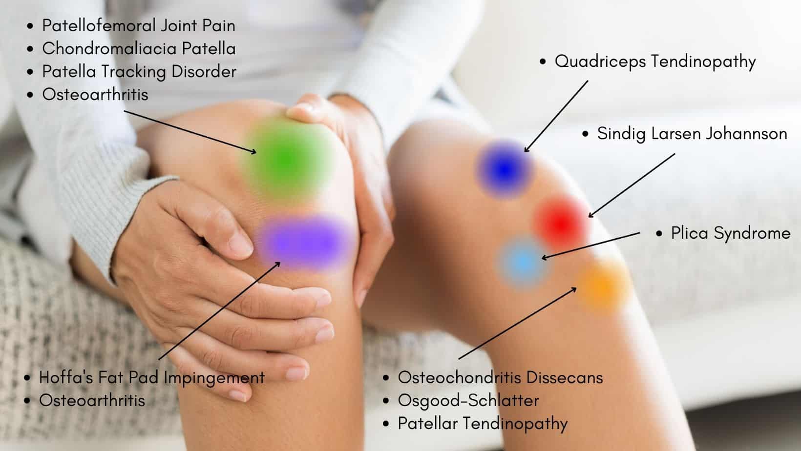 Anterior Knee Pain Location Chart  