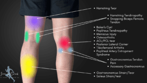 Knee Pain Location Chart | Learn the Pain Location of Knee Injuries