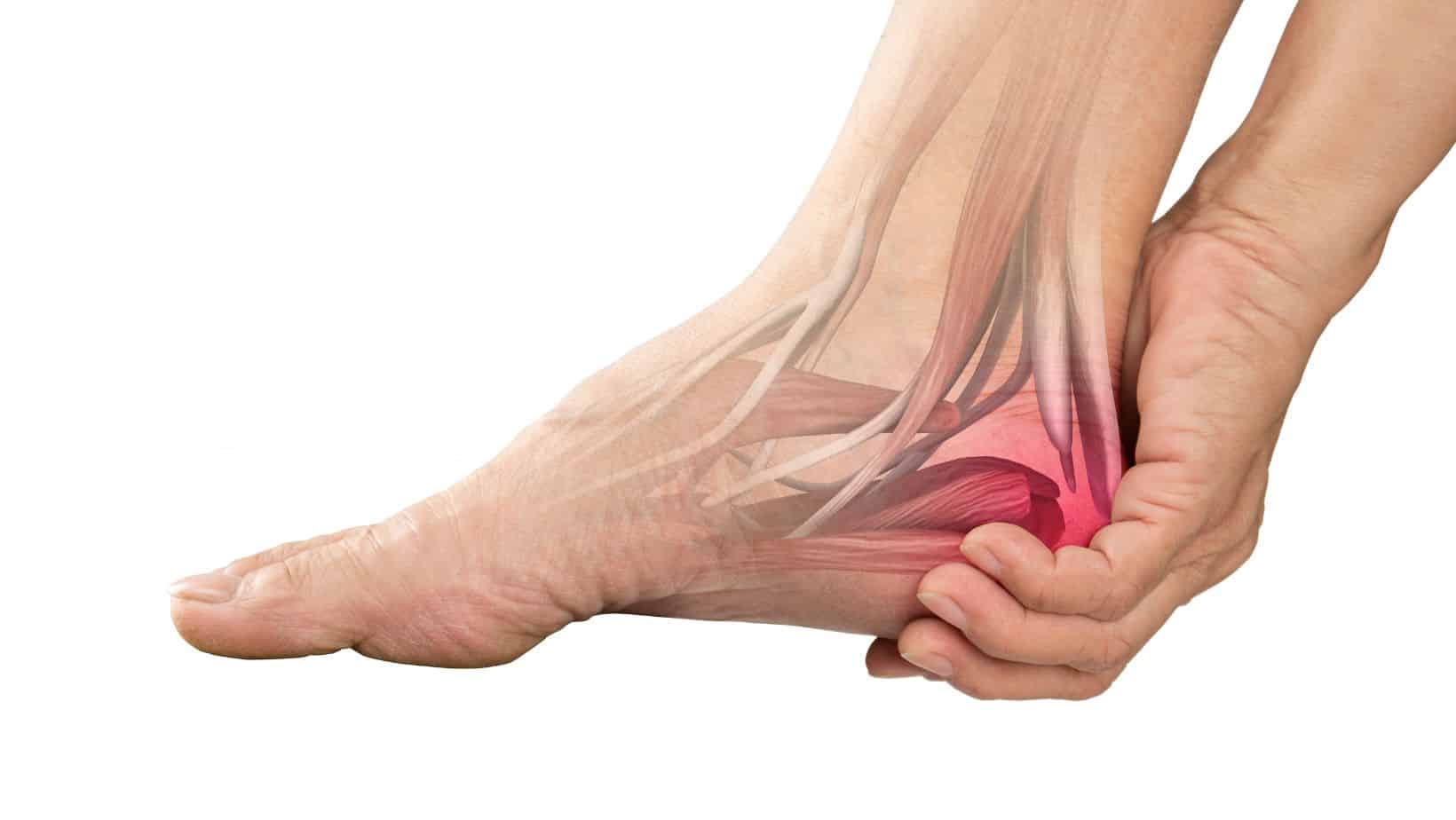 Bruised Heel Symptoms