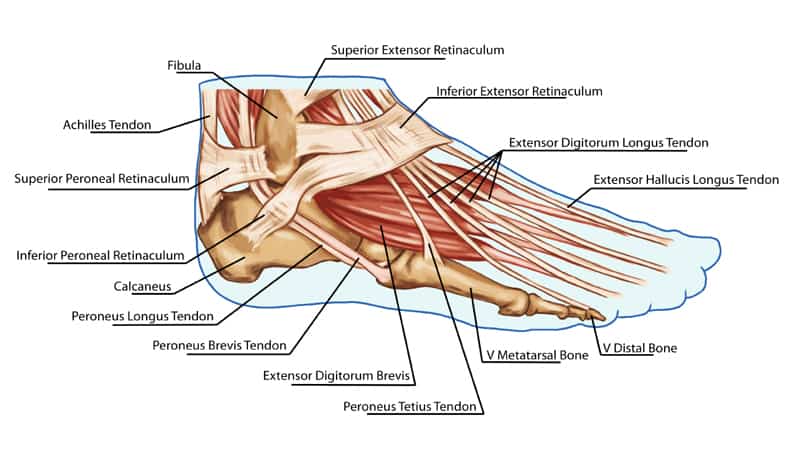 strained-leg-tendon