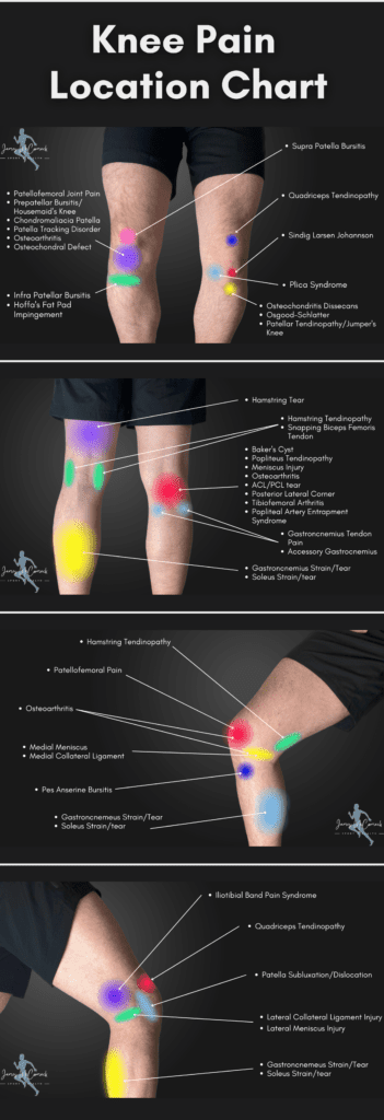 Knee Pain Location Chart Picture Diagram