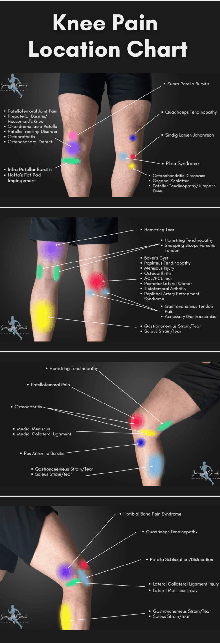 Knee Pain Location Chart Learn the Pain Location of Knee Injuries