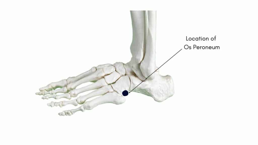 Location of Os Peroneum Diagram