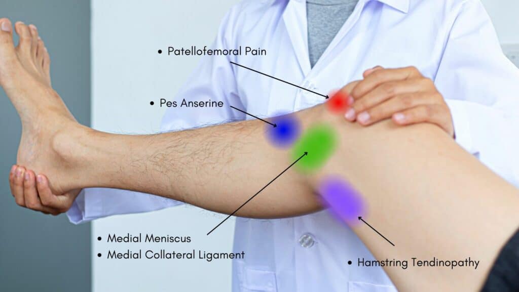 photo of medial knee pain location chart