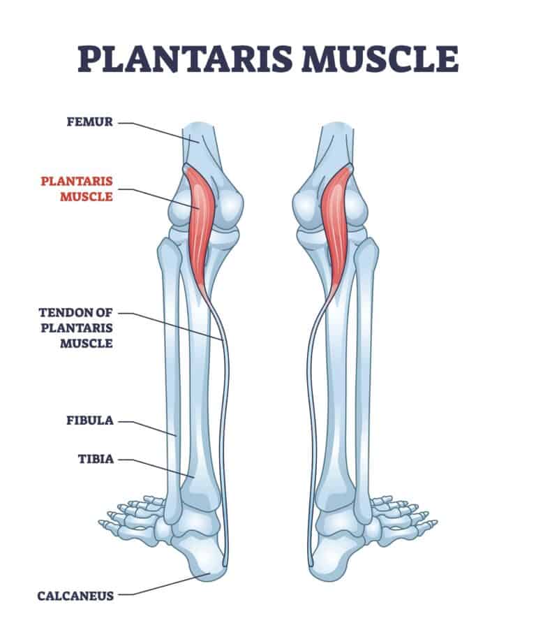 Plantaris Muscle: Learn the Symptoms, Causes & Treatment