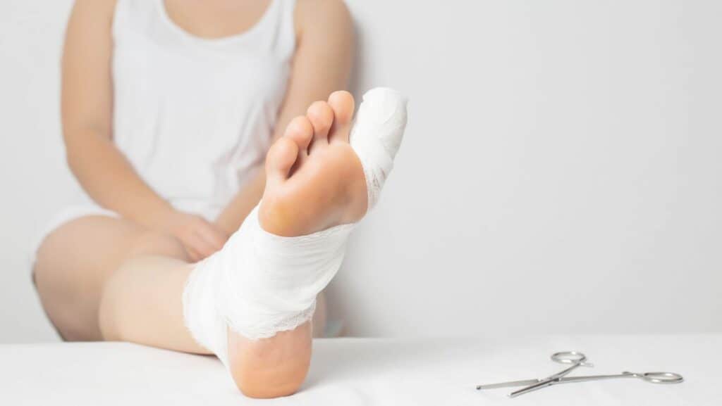 Sprained Toe Diagnosis And Treamtment By A Foot Specialist 3078