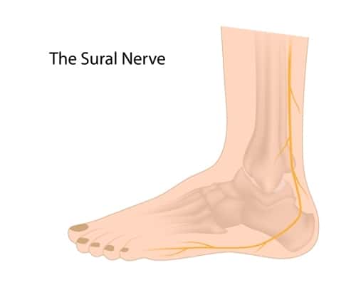 Sural Nerve Diagram
