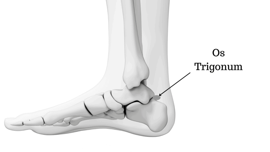 Os Trigonum Diagram