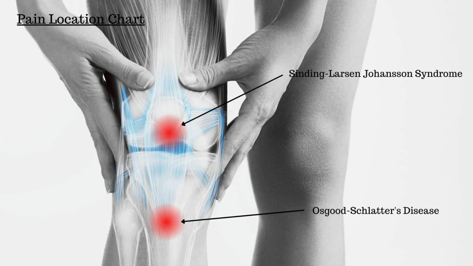 What Causes Knee Pain Going Down Stairs? Learn How to fix it!