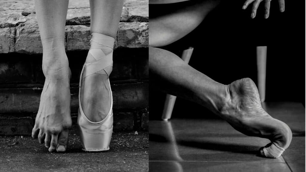 Picture of Ballerina feet damage