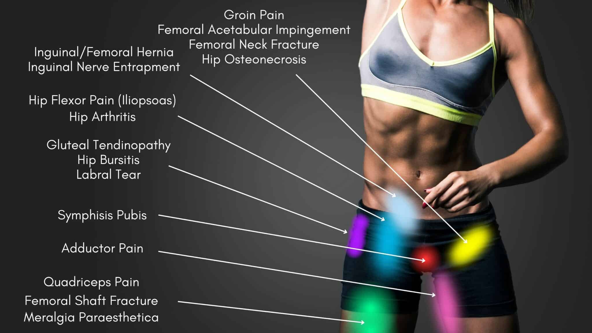 hip-pain-location-diagram-hip-pain-location-chart