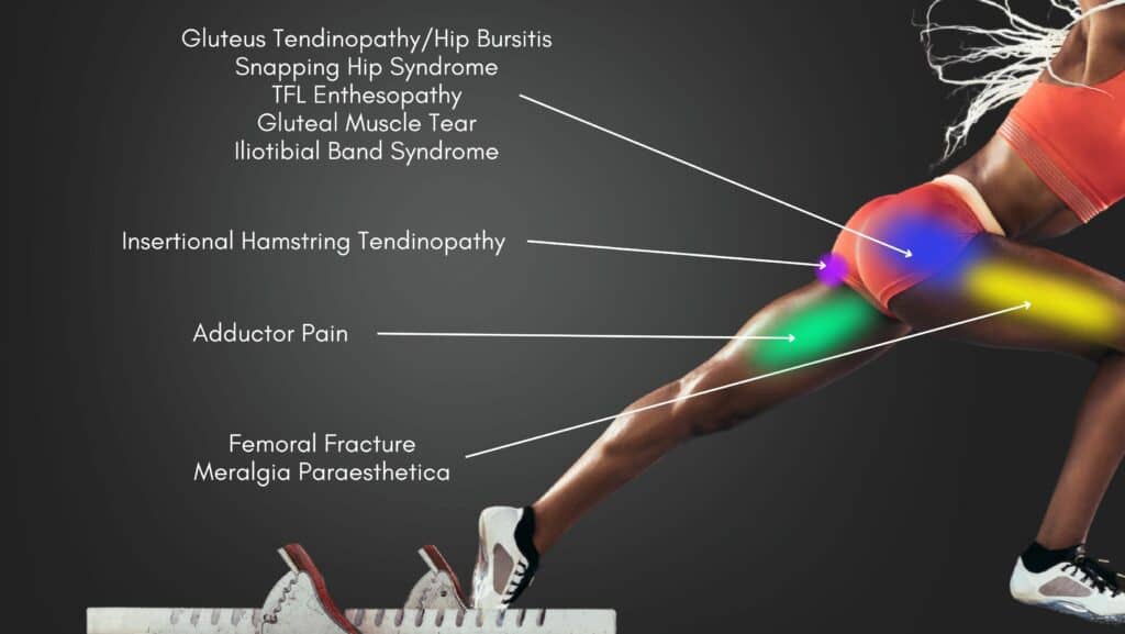Hip Pain Location Diagram Lateral View